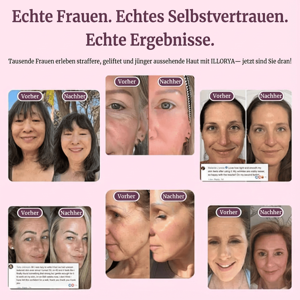 Menopause Kollagen-Kalzium Dichte-Balsam