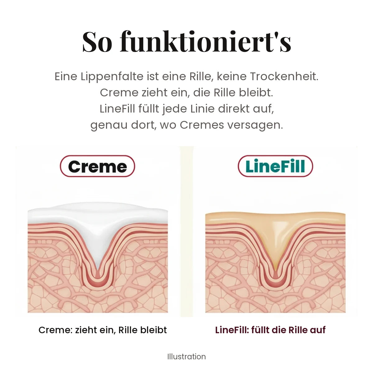 So funktioniert LineFill: füllt die Rille auf