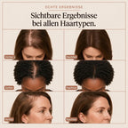 Illorya Haarserum