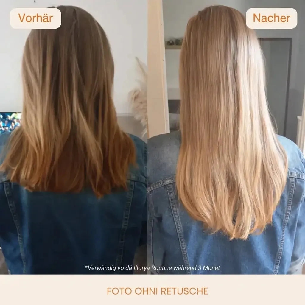 Illorya Haarserum