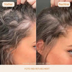 Illorya Haarserum